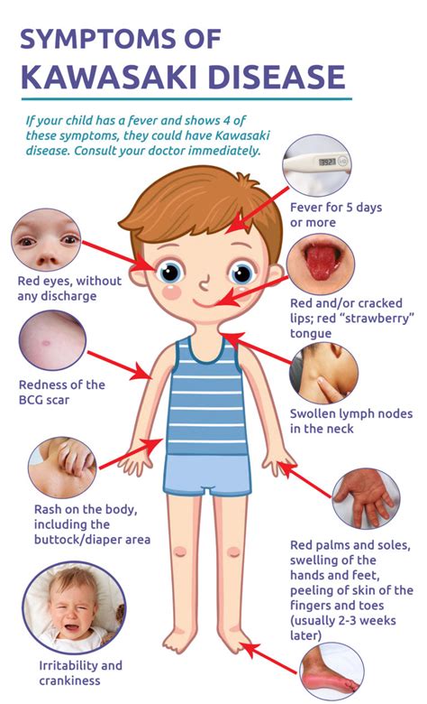 What Are The Stages Of Kawasaki Disease?
