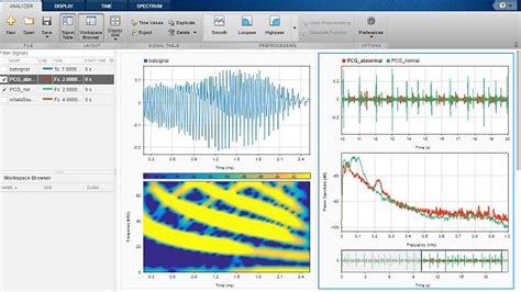 Signal Processing Matlab Algorithm