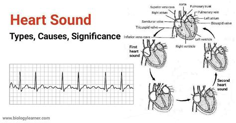 significance sound