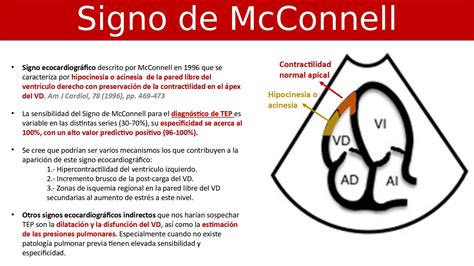 signo de mcconnell