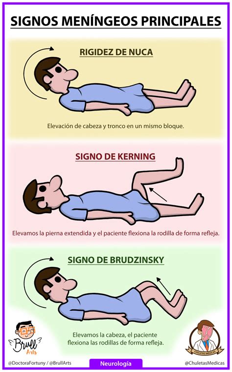 signos de meningitis kerning y brudzinski