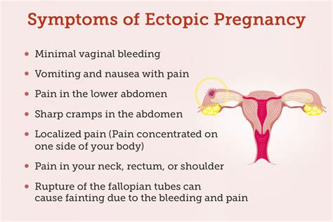 Ectopic Pregnancy Rupture Symptoms Management