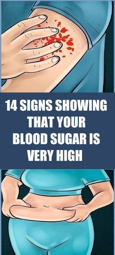 8 Warning Signs Of HIGH Blood Sugar Concentration In Your