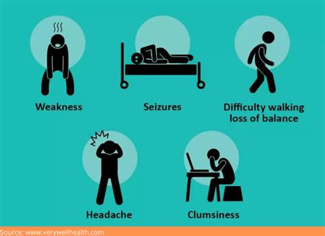 signs and symptoms of glioblastoma
