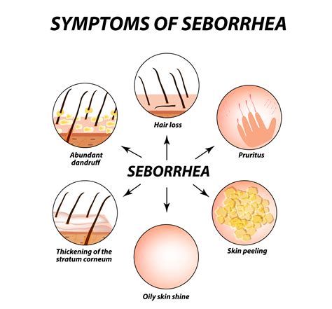 signs and symptoms of seborrheic dermatitis