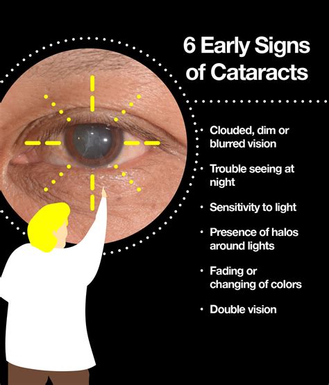 signs of cataracts symptoms