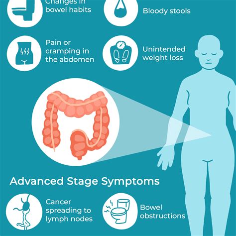 signs of colon cancer in teens