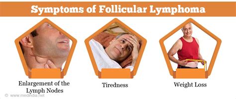 signs of follicular lymphoma