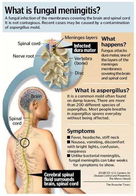 signs of fungal meningitis