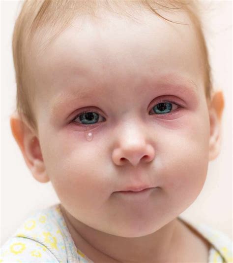 signs of pink eye in kids