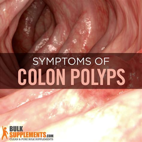 signs of polyps in colon