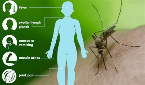 signs of west nile virus in humans