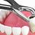 simple tooth extraction cost