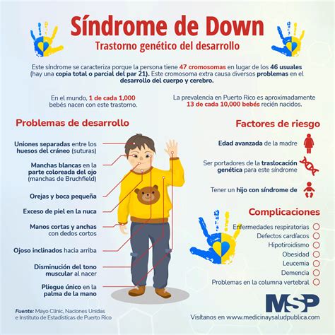 sindrome de down pdf