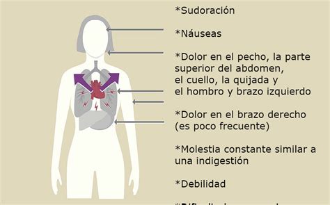 sintomas de un pre infarto