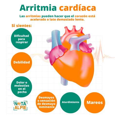 sintomas de una arritmia cardiaca