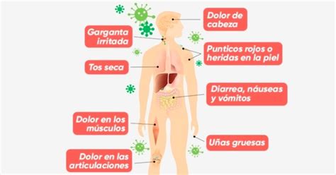 ¿Cuáles son los primeros sintomas del sida y cómo identificarlos?