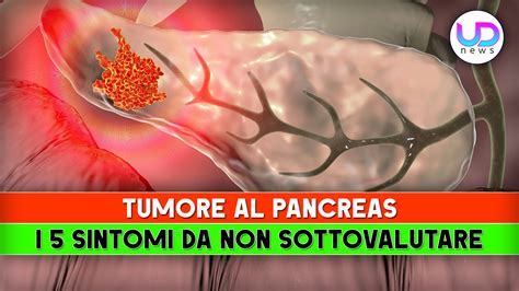 sintomi del tumore al pancreas