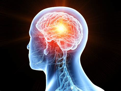 sintomi di un tumore al cervello