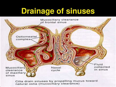 Sinus Drainage Causing Gagging