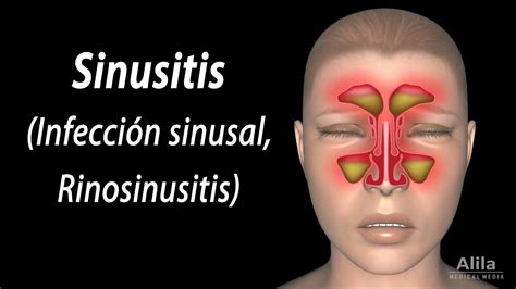 sinus meaning in spanish