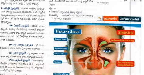 sinus symptoms in telugu