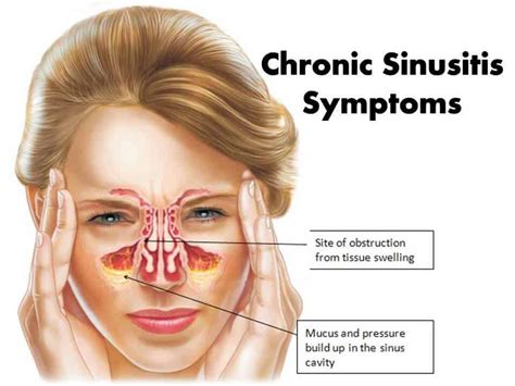 sinusitis clinic near me