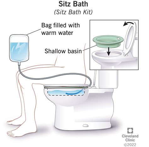 Sitz Bath Video