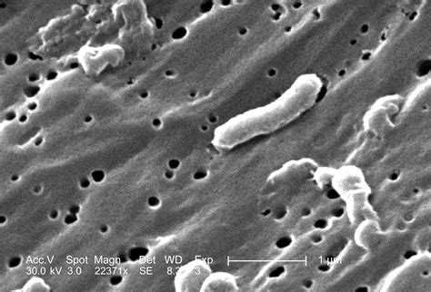 size of vibrio cholerae