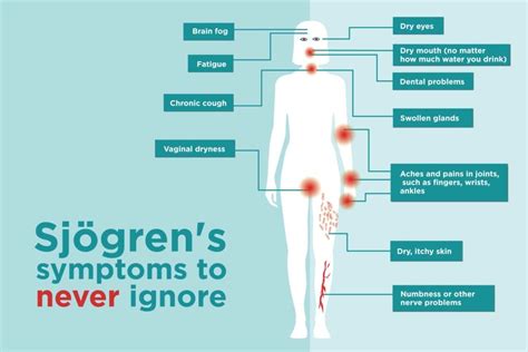 sjogren's syndrome and itchy skin