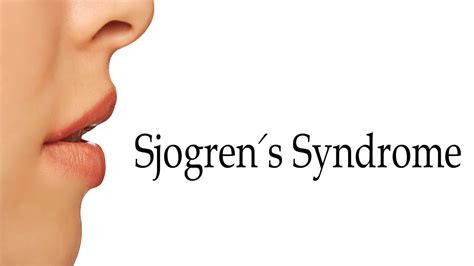 sjogren's syndrome pronunciation