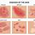 skin conditions dermatology common
