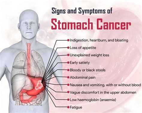 skin cancer photos on stomach