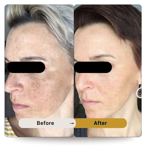 skin tone and texture