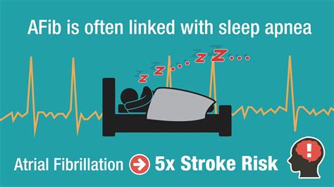 sleep apnea and afib correlation