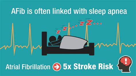 sleep apnea and afib mayo clinic