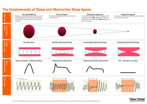 sleep apnea chart for breathing