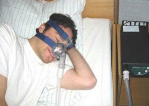 sleep apnea london ontario