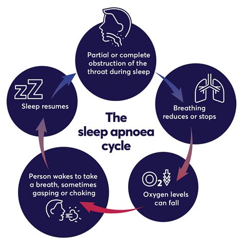 sleep apnea nhs inform