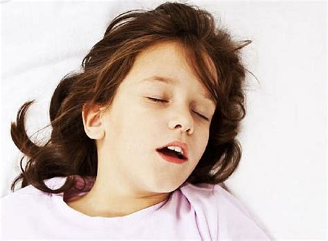 sleep apnea pada anak