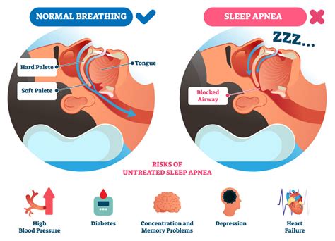 sleep apnea solutions in my area