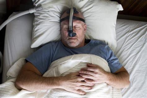 sleep apnea surgery near california