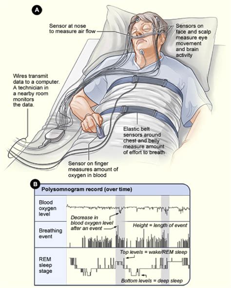 sleep apnea test results mean diagnosis