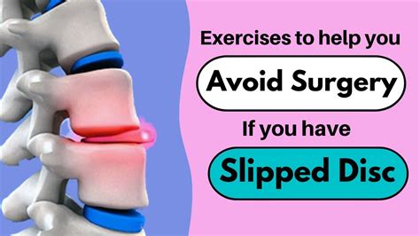 Slipped Disc Exercises To Avoid