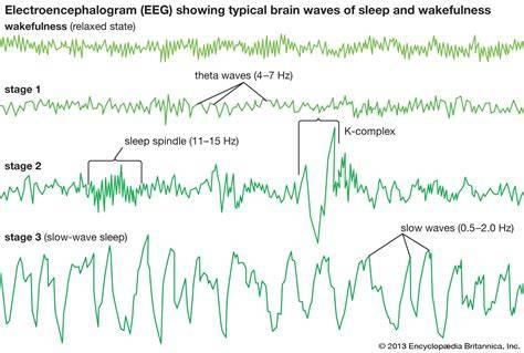 Deep Sleep Linked to Slower Parkinson's Progression
