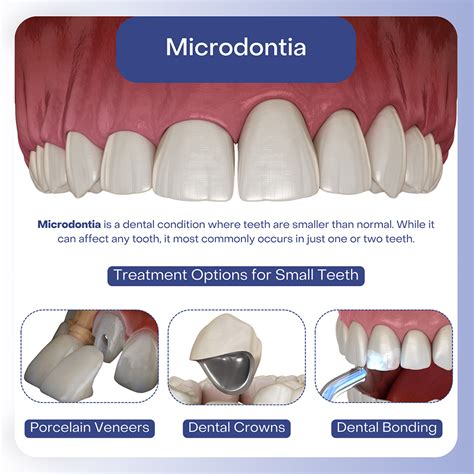 Small Teeth Secrets: Stunning Transformations Unveiled