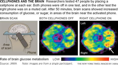 smartphone addiction brain changes