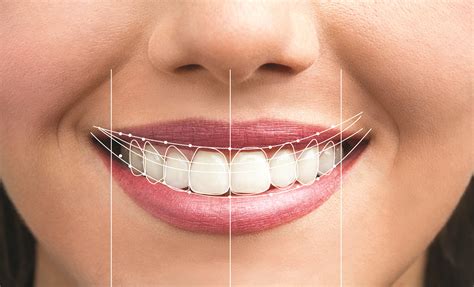 smile design dentistry insurance