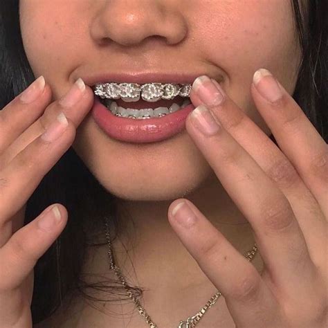 Smiley Braces Grillz