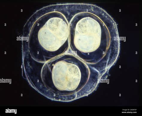 Snail Eggs Under Microscope
